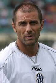 Antonio conte, il trapianto di capelli non è un mistero. Antonio Conte Trapianto Capelli Rifatti Chirurgia Estetica Vip