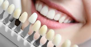 We did not find results for: 50 Shades Of White How To Choose The Right Shade For Teeth Whitening