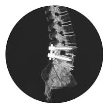 Maybe you would like to learn more about one of these? The Different Levels Of Spinal Cord Injuries Virginia Spine Specialists