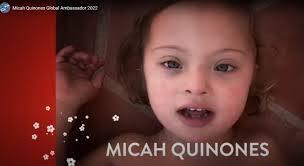 🧩Today is #AutisticPrideDay! Did you know that up to 18% of people with  #DownSyndrome have a dual diagnosis of #Autism? At GLOBAL and at our  Affiliates the Linda Crnic Institute for Down