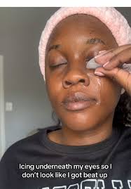 Is It Good to Put Ice around Your Eyes