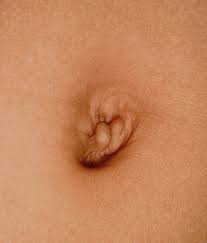 Image result for Umbilicus botryoides