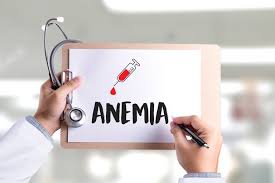 We did not find results for: Ketahui Tips Pencegahan Anemia Lebih Dini Lifepack Id