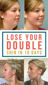 Home Remedies And Facial Exercise To Get Rid Of Double Chin Wrap Overnight Double Chin Exercises Chin Exercises Facial Exercises
