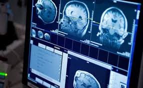 A normal mri costs $2,600 without insurance. Mri Mayo Clinic