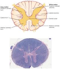 Central canal stenosis is the medical term for the narrowing of the spinal canal. 12 5 Spinal Cord Medicine Libretexts