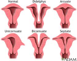 Image result for uterus