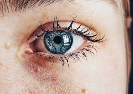 Como Deshacerse De Las Arrugas Del Contorno De Los Ojos Fundacionconsalud