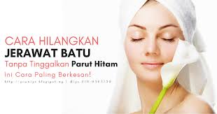 Antara khasiat buah tomato ialah baik untuk. Hilangkan Jerawat Batu Dengan Cepat Tanpa Tinggalkan Parut Ini Cara Paling Berkesan Amizah Azid