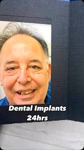 Dr.Implant -Miami/Pembroke Pines/Delray Beach (@dr.implantexperts) ·  Instagram 照片和视频