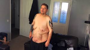 Franco was busted when he attempted to pull over a police officer in an unmarked car. The World S Most Obese Man S Attempt To Lose Weight Bbc News
