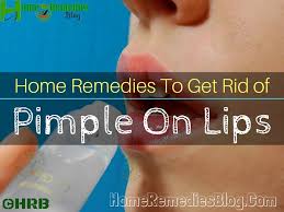 How to get rid of pimple on lip apply a cold compress. 15 Home Remedies To Get Rid Of Pimple On Lip Naturally Home Remedies Blog
