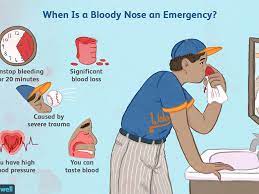 Nosebleeds are usually caused by dryness in the nose and the normal rubbing and picking that all kids do when their noses are blocked or itchy. When A Bloody Nose Becomes An Emergency