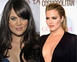 Not only that, but this reality tv star was also quite overweight in the young years. Khloe Kardashian Then And Now All The Surgeries She May Have Had Since 2008 According To Surgeon Photos Celebrities Enstars