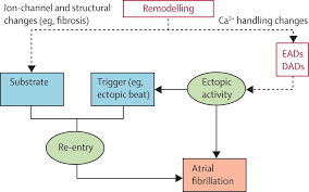 Atrial fibrillation (afib) is incurable, but it can be managed with treatments. New Antiarrhythmic Drugs For Treatment Of Atrial Fibrillation The Lancet