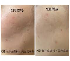 天神竹井皮膚科美容皮膚科