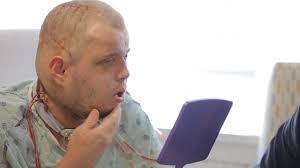 Face transplant and organ recipients meet donor's mother for the first time 