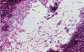Last updated may 16, 2013. Listeria Monocytogenes Gram Stain As Seen In A Light Microscope Download Scientific Diagram