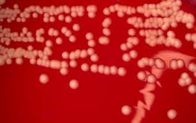 Image result for Staphylococcus Saprophyticus