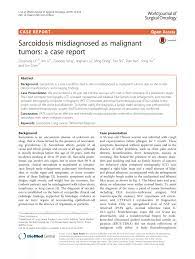Researchers emphasize that clinicians should be aware of systemic sarcoidosis because it can easily be mistaken for cancer progression. Pdf Sarcoidosis Misdiagnosed As Malignant Tumors A Case Report