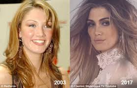 Full stop management/azoff music management all bookings & inquiries: Delta Goodrem May Have Had A Nose Job Dr Haworth