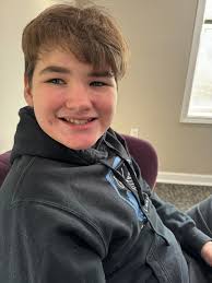 Luke Boan got braces today and his physical for Volleyball. Things are  starting to get better for him. Here we go again, Another beautiful  transformation. Before/during/after!