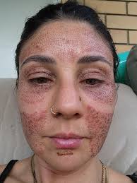 Just got this piece of sycamore for the Mantle (12 yrs dry) just wondering  what's the best treatment to put