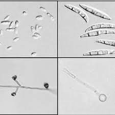 Morphological Characteristics Of Fusarium Oxysporum A Oval To Download Scientific Diagram