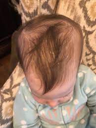 21 top baby shampoos for dry scalp (2021 update). Top 3 Natural Shampoo To Treat Dry Scalp In Babies T Is For Tame