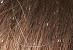 Blonde Hair What Does Lice Look Like