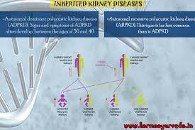 Is Kidney Disease Hereditary Karma Ayurveda