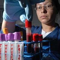 Richard F. Eveleth, a civilian laboratory technician, sets the Automatic  Analyzer II for blood testing in the laboratory at the medical department  activity (MEDDAC) health services complex