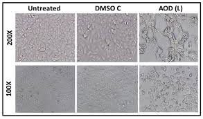 Image result for Acridocarpus chloropterus