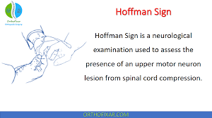 Image result for Spurling Sign