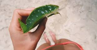 Pin On Burn Sunburn Solutions