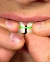 Teeth gap bands can fix teeth gaps in as little as 30 days when used properly. Orthodontists Warn Against Uptick In Diy Teeth Straightening Abc News