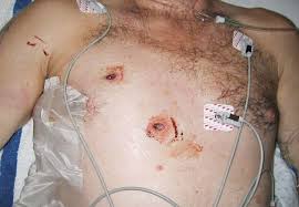 Damage depends on the part of the body hit, the path the bullet follows through the body, and the type and speed of the bullet. 9mm Or 40 Caliber The Survival Summit