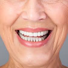 Brilliant Composite Veneers Ldn Dental 500 5 Star Reviews