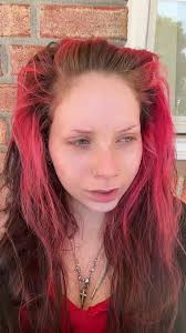 Saving Eliza Go Fund Me Part 1