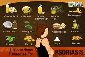 Psoriasis Treatment Simple Natural Home Remedies To Reduce Symptoms Psoriasis Natural Psoriasis Treatment Psoriasis Treatment
