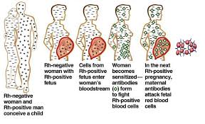 Image result for Direct Coombs
