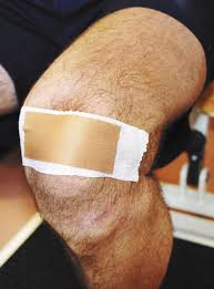Patellofemoral Taping Pain Relief Mechanisms Lower Extremity Review Magazine