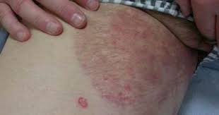 Pin On Best Diabetes Solutions