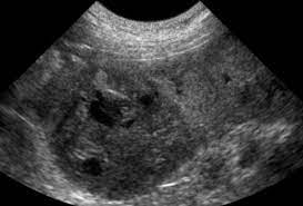 In some cases, one cause for the enlargement and inflammation of the spleen is a condition known as eosinophilic gastroenteritis. Splenectomy For Your Dog Animal Hospital Maple Orchard