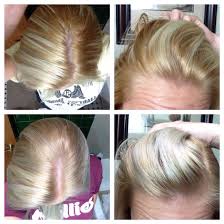 Wella T14 Toner Diy Before After This Is My Experience Followed Directions On Box Except Only Left O Diy Hair Toner Temporary Hair Dye Diy Wella Hair Color
