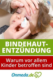 Bindehautentzundung Konjunktivitis Ursachen Symptome Behandlung Beauty Body Health