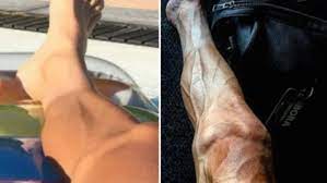 El deportista participa en el tour de francia, una competición que le demanda un gran esfuerzo físico. Asi Quedan Las Piernas De Un Ciclista Tras El Tour De France Telefe Noticias