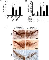 Accumulation of the Authentic Parkin Substrate Aminoacyl-tRNA Synthetase  Cofactor, p38/JTV-1, Leads to Catecholaminergic Cell Death