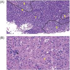 Nak masuk uitm universiti teknologi mara, tapi tak tahu bagaimana nak mohon, apa yang perlu dilakukan? Exome Sequencing Identifies Potentially Druggable Mutations In Nasopharyngeal Carcinoma Scientific Reports