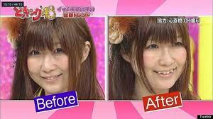 Yaeba Japan S Crooked Teeth Trend Beauty Standards Beauty Trends Teeth